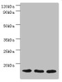 Western blot; All lanes: Mitochondrial import receptor subunit TOM20 homolog antibody at 3µg/ml; Lane 1: Mouse brain tissue; Lane 2: Hela whole cell lysate; Lane 3: Mouse liver tissue; Secondary; Goat polyclonal to rabbit IgG at 1/10000 dilution; Predicted band size: 16 kDa; Observed band size: 16 kDa; Western blot; All lanes: Mitochondrial import receptor subunit TOM20 homolog antibody at 3µg/ml; Lane 1: Mouse brain tissue; Lane 2: Hela whole cell lysate; Lane 3: Mouse liver tissue; Secondary; Goat polyclonal to rabbit IgG at 1/10000 dilution; Predicted band size: 16 kDa; Observed band size: 16 kDa;