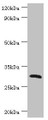 Western blot; All lanes: C-type lectin domain family 12 member A antibody at 2µg/ml + Mouse skeletal muscle tissue; Secondary; Goat polyclonal to rabbit IgG at 1/10000 dilution; Predicted band size: 31, 33, 9, 28, 25 kDa; Observed band size: 31 kDa;