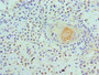 Immunohistochemistry of paraffin-embedded human breast tissue using CAC10579 at dilution of 1:100 Immunohistochemistry of paraffin-embedded human breast tissue using CAC10579 at dilution of 1:100