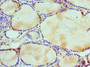 Immunohistochemistry of paraffin-embedded human thyroid tissue using CAC10579 at dilution of 1:100 Immunohistochemistry of paraffin-embedded human thyroid tissue using CAC10579 at dilution of 1:100