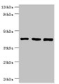Western blot; All lanes: SWI/SNF-related matrix-associated actin-dependent regulator of chromatin subfamily B member 1 antibody at 8µg/ml; Lane 1: Hela whole cell lysate; Lane 2: 293T whole cell lysate; Lane 3: Mouse stomach tissue; Secondary; Goat polyclonal to rabbit IgG at 1/10000 dilution; Predicted band size: 45, 44 kDa; Observed band size: 45 kDa;
