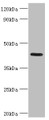 Western blot; All lanes: Nitrogen permease regulator 2-like protein antibody at 7µg/ml + Mouse skeletal muscle tissue; Secondary; Goat polyclonal to rabbit IgG at 1/10000 dilution; Predicted band size: 44, 24 kDa; Observed band size: 44 kDa;