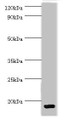 Western blot; All lanes: C-C motif chemokine 28 antibody at 5µg/ml + Mouse spleen tissue; Secondary; Goat polyclonal to rabbit IgG at 1/10000 dilution; Predicted band size: 15, 13 kDa; Observed band size: 15 kDa;