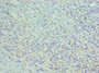 Immunohistochemistry of paraffin-embedded human epityphlon tissue using CAC10589 at dilution of 1:100