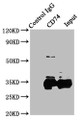 Immunoprecipitating CD74 in Raji whole cell lysate; ,Lane 1: Rabbit control IgG instead in Raji whole cell lysate. For western blotting, a HRP-conjugated Protein G antibody was used as the secondary antibody (1/2000); ,Lane 2: CAC10589 (8µg) + Raji whole cell lysate (500µg); ,Lane 3: Raji whole cell lysate (10µg)