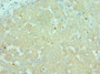 Immunohistochemistry of paraffin-embedded human liver tissue using CAC10593 at dilution of 1:100 Immunohistochemistry of paraffin-embedded human liver tissue using CAC10593 at dilution of 1:100