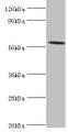 Western blot; All lanes: Hyaluronidase-2 antibody at 4µg/ml + Mouse lung tissue; Secondary; Goat polyclonal to rabbit IgG at 1/10000 dilution; Predicted band size: 54 kDa; Observed band size: 54 kDa; Western blot; All lanes: Hyaluronidase-2 antibody at 4µg/ml + Mouse lung tissue; Secondary; Goat polyclonal to rabbit IgG at 1/10000 dilution; Predicted band size: 54 kDa; Observed band size: 54 kDa;