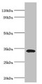 Western blot; All lanes: Low density lipoprotein receptor adapter protein 1 antibody at 4µg/ml + Mouse liver tissue; Secondary; Goat polyclonal to rabbit IgG at 1/10000 dilution; Predicted band size: 34 kDa; Observed band size: 34 kDa; Western blot; All lanes: Low density lipoprotein receptor adapter protein 1 antibody at 4µg/ml + Mouse liver tissue; Secondary; Goat polyclonal to rabbit IgG at 1/10000 dilution; Predicted band size: 34 kDa; Observed band size: 34 kDa;