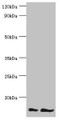 Western blot; All lanes: NEDD8 antibody at 16µg/ml; Lane 1: Mouse heart tissue; Lane 2: Mouse spleen tissue; Secondary; Goat polyclonal to rabbit IgG at 1/10000 dilution; Predicted band size: 9 kDa; Observed band size: 9 kDa;