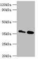 Western blot; All lanes: CTSK antibody at 8µg/ml; Lane 1: MCF-7 whole cell lysate; Lane 2: Rat brain tissue; Secondary; Goat polyclonal to rabbit IgG at 1/10000 dilution; Predicted band size: 37 kDa; Observed band size: 37 kDa;
