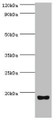 Western blot; All lanes: Urotensin-2 antibody at 8µg/ml + Rat brain tissue; Secondary; Goat polyclonal to rabbit IgG at 1/10000 dilution; Predicted band size: 15, 17 kDa; Observed band size: 15 kDa;