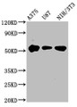 Western Blot; , Positive WB detected in: A375 whole cell lysate, U87 whole cell lysate, NIH/3T3 whole cell lysate; , All lanes: STK3 antibody at 3.4µg/ml; , Secondary; , Goat polyclonal to rabbit IgG at 1/50000 dilution; , Predicted band size: 57, 60 kDa; , Observed band size: 57 kDa