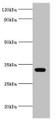 Western blot; All lanes: AGPAT1 antibody at 6µg/ml + K562 whole cell lysate; Secondary; Goat polyclonal to rabbit IgG at 1/10000 dilution; Predicted band size: 32 kDa; Observed band size: 32 kDa