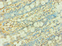Immunohistochemistry of paraffin-embedded human colon tissue using CAC10621 at dilution of 1:100