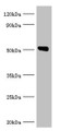 Western blot; All lanes: Annexin A11 antibody at 14µg/ml + U251 whole cell lysate; Secondary; Goat polyclonal to rabbit IgG at 1/10000 dilution; Predicted band size: 55, 52 kDa; Observed band size: 52 kDa;