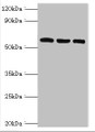 Western blot; All lanes: Thioredoxin reductase 2, mitochondrial antibody at 6µg/ml; Lane 1: Mouse liver tissue; Lane 2: Mouse gonad tissue; Lane 3: Hela whole cell lysate; Secondary; Goat polyclonal to rabbit IgG at 1/10000 dilution; Predicted band size: 57, 54, 47, 31 kDa; Observed band size: 57 kDa;
