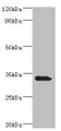 Western blot; All lanes: Mitochondrial brown fat uncoupling protein 1 antibody at 2µg/ml + Mouse kidney tissue; Secondary; Goat polyclonal to rabbit IgG at 1/10000 dilution; Predicted band size: 33 kDa; Observed band size: 33 kDa;