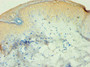 Immunohistochemistry of paraffin-embedded human skin tissue using CAC10643 at dilution of 1:100 Immunohistochemistry of paraffin-embedded human skin tissue using CAC10643 at dilution of 1:100