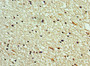Immunohistochemistry of paraffin-embedded human brain tissue using CAC10659 at dilution of 1:100