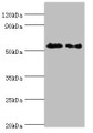 Western blot; All lanes: ATG4C antibody at 9µg/ml; Lane 1: Mouse lung tissue; Lane 2: HepG2 whole cell lysate; Secondary; Goat polyclonal to rabbit IgG at 1/10000 dilution; Predicted band size: 52 kDa; Observed band size: 52 kDa;