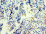 Immunohistochemistry of paraffin-embedded human lung tissue using CAC10662 at dilution of 1:100 Immunohistochemistry of paraffin-embedded human lung tissue using CAC10662 at dilution of 1:100