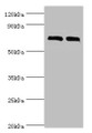 Western blot; All lanes: DHX58 antibody at 12µg/ml; Lane 1: 293T whole cell lysate; Lane 2: Rat kidney tissue; Secondary; Goat polyclonal to rabbit IgG at 1/10000 dilution; Predicted band size: 77 kDa; Observed band size: 77 kDa;