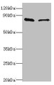 Western blot; All lanes: SLC39A6 antibody at 10µg/ml; Lane 1: Hela whole cell lysate; Lane 2: 293T whole cell lysate; Secondary; Goat polyclonal to rabbit IgG at 1/10000 dilution; Predicted band size: 86, 49 kDa; Observed band size: 86 kDa;