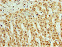 Immunohistochemistry of paraffin-embedded human adrenal gland tissue using CAC10679 at dilution of 1:100 Immunohistochemistry of paraffin-embedded human adrenal gland tissue using CAC10679 at dilution of 1:100