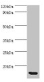 Western blot; All lanes: CCL11 antibody at 5µg/ml + Hela whole cell lysate; Secondary; Goat polyclonal to rabbit IgG at 1/10000 dilution; Predicted band size: 11 kDa; Observed band size: 11 kDa; Western blot; All lanes: CCL11 antibody at 5µg/ml + Hela whole cell lysate; Secondary; Goat polyclonal to rabbit IgG at 1/10000 dilution; Predicted band size: 11 kDa; Observed band size: 11 kDa;
