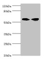 Western blot; All lanes: AHCYL1 antibody at 12µg/ml; Lane 1: Hela whole cell lysate; Lane 2: 293T whole cell lysate; Secondary; Goat polyclonal to rabbit IgG at 1/10000 dilution; Predicted band size: 59, 54 kDa; Observed band size: 59 kDa;