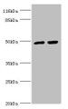 Western blot; All lanes: TRIM13 antibody at 1.44µg/ml; Lane 1: 293T whole cell lysate; Lane 2: Hela whole cell lysate; Secondary; Goat polyclonal to rabbit IgG at 1/10000 dilution; Predicted band size: 47, 20, 48 kDa; Observed band size: 47 kDa