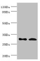 Western blot; All lanes: ZWINT antibody at 8.93µg/ml; Lane 1: Hela whole cell lysate; Lane 2: Mouse liver tissue; Secondary; Goat polyclonal to rabbit IgG at 1/10000 dilution; Predicted band size: 32, 26 kDa; Observed band size: 32 kDa;