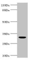 Western blot; All lanes: KLK10 antibody at 1.48µg/ml + THP-1 whole cell lysate; Secondary; Goat polyclonal to rabbit IgG at 1/10000 dilution; Predicted band size: 30 kDa; Observed band size: 30 kDa