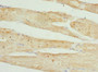 Immunohistochemistry of paraffin-embedded human skeletal muscle tissue using CAC10712 at dilution of 1:100