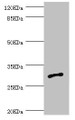 Western blot; All lanes: AGPAT2 antibody at 1.09µg/ml + Jurkat whole cell lysate; Secondary; Goat polyclonal to rabbit IgG at 1/10000 dilution; Predicted band size: 31, 28 kDa; Observed band size: 31 kDa;