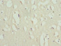 Immunohistochemistry of paraffin-embedded human brain tissue using CAC10714 at dilution of 1:100