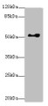 Western blot; All lanes: EIF2S3antibody at 0.83µg/ml + Hela whole cell lysate; Secondary; Goat polyclonal to rabbit IgG at 1/10000 dilution; Predicted band size: 51 kDa; Observed band size: 51 kDa;