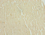 Immunohistochemistry of paraffin-embedded human heart tissue using CAC10722 at dilution of 1:100 Immunohistochemistry of paraffin-embedded human heart tissue using CAC10722 at dilution of 1:100