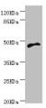 Western blot; All lanes: CYTH2 antibody at 5.1µg/ml + MCF-7 whole cell lysate; Secondary; Goat polyclonal to rabbit IgG at 1/10000 dilution; Predicted band size: 47 kDa; Observed band size: 47 kDa