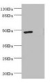 Western blot; All lanes: LILRB4 antibody at 3.45µg/ml; Lane 1: MCF-7 whole cell lysate; Lane 2: A549 whole cell lysate; Secondary; Goat polyclonal to rabbit IgG at 1/10000 dilution; Predicted band size: 50 kDa; Observed band size: 50 kDa