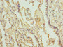 Immunohistochemistry of paraffin-embedded human lung tissue using CAC10728 at dilution of 1:100