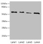 Western blot; All lanes: RTKN antibody at 4.66µg/ml; Lane 1: A431 whole cell lysate; Lane 2: HepG2 whole cell lysate; Lane 3: MCF-7 whole cell lysate; Lane 4: Mouse brain tissue; Secondary; Goat polyclonal to rabbit IgG at 1/10000 dilution; Predicted band size: 63, 62, 57 kDa; Observed band size: 63 kDa;
