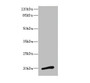 Western blot; All lanes: NMUantibody at 3.13µg/ml + Mouse stomach tissue; Secondary; Goat polyclonal to rabbit IgG at 1/10000 dilution; Predicted band size: 20 kDa; Observed band size: 20 kDa;
