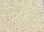 Immunohistochemistry of paraffin-embedded human liver tissue using CAC10737 at dilution of 1:100