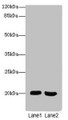 Western blot; All lanes: MSRB2antibody at 2.66µg/ml; Lane 1: Mouse heart tissue; Lane 2: Mouse brain tissue; Secondary; Goat polyclonal to rabbit IgG at 1/10000 dilution; Predicted band size: 20 kDa; Observed band size: 20 kDa;