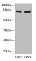 Western blot; All lanes: TARS antibody at 4.85µg/ml; Lane 1: A549 whole cell lysate; Lane 2: Hela whole cell lysate; Secondary; Goat polyclonal to rabbit IgG at 1/10000 dilution; Predicted band size: 84, 87 kDa; Observed band size: 84 kDa
