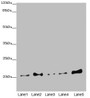 Western blot; All lanes: COMMD1 antibody at 5.36µg/ml; Lane 1: A549 whole cell lysate; Lane 2: Jurkat whole cell lysate; Lane 3: MCF-7 whole cell lysate; Lane 4: Hela whole cell lysate; Lane 5: HepG2 whole cell lysate; Secondary; Goat polyclonal to rabbit IgG at 1/10000 dilution; Predicted band size: 22, 18 kDa; Observed band size: 22 kDa