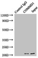 Immunoprecipitating COMMD1 in HepG2 whole cell lysate; , Lane 1: Rabbit control IgG instead of (1µg) instead in HepG2 whole cell lysate. For western blotting, a HRP-conjugated anti-rabbit IgG, specific to the non-reduced form of IgG was used as the Secondary antibody (1/50000); , Lane 2: CAC10746 (4µg) + HepG2 whole cell lysate (500µg); , Lane 3: HepG2 whole cell lysate (20µg)