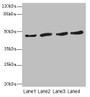 Western blot; All lanes: RASSF5antibody at 5.46µg/ml; Lane 1: Thp-1 whole cell lysate; Lane 2: 293T whole cell lysate; Lane 3: Jurkat whole cell lysate; Lane 4: A549 whole cell lysate; Secondary; Goat polyclonal to rabbit IgG at 1/10000 dilution; Predicted band size: 48, 31, 38 kDa; Observed band size: 48 kDa;