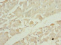 Immunohistochemistry of paraffin-embedded human heart tissue using CAC10752 at dilution of 1:100